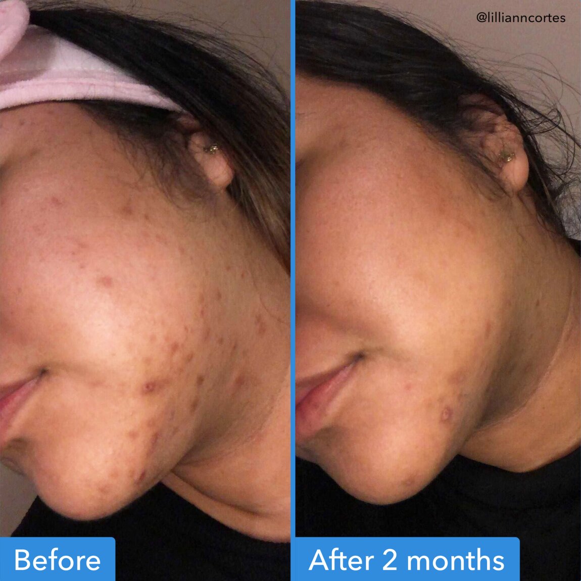 discoloration-correcting-serum-p4 zb_p.jpg