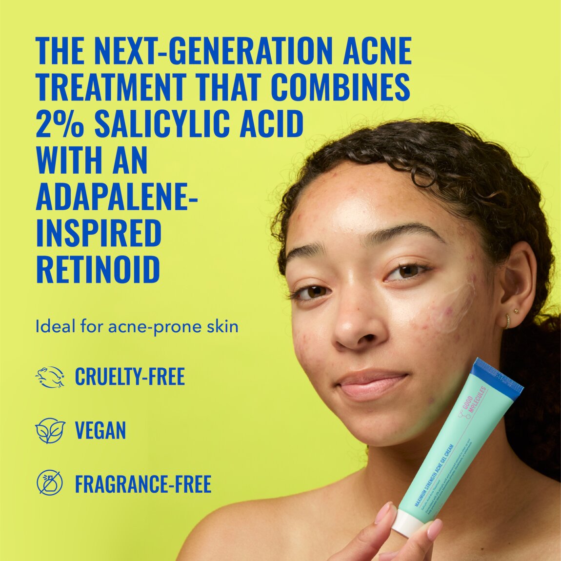 maximum-strength-acne-gel-cream-y5 zb_p.jpg