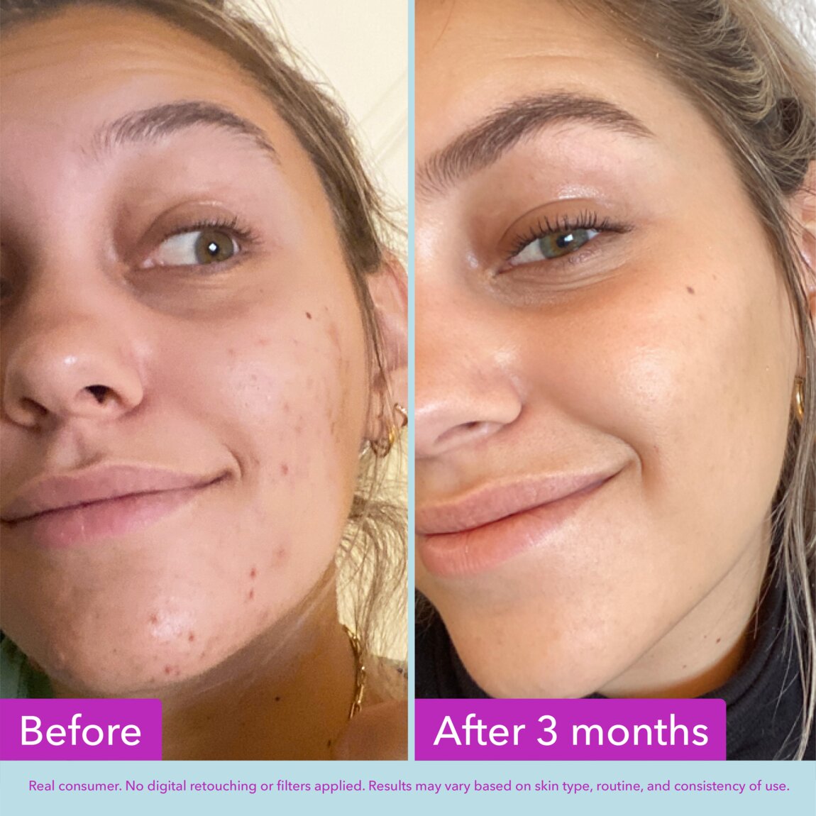 niacinamide-brightening-toner-k8 zb_p.jpg