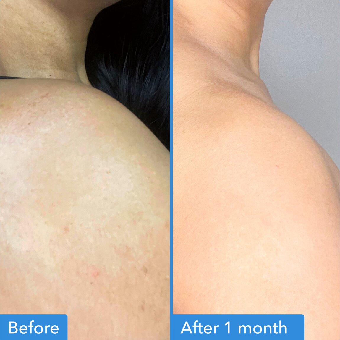 discoloration-correcting-body-treatment-y4 zb_p.jpg